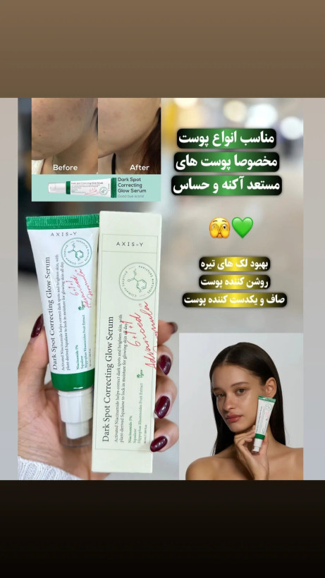 سرم ضد لک گیاهی اکسیس وای